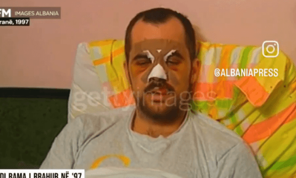 Archived view from 1997, when Edi Rama was brutally beaten as an opponent of then-power
