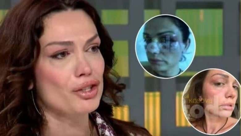 Drousha Latifi slaps Edona Lallosh’s face: When you asked for protection, the institutions acted and your husband was arrested several times.